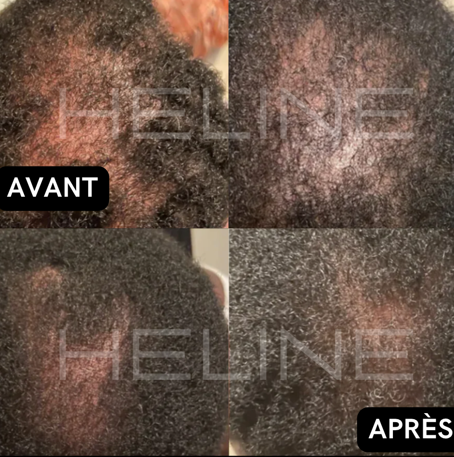La meilleure huile de ricin bio (Conarky)