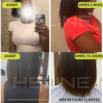 La meilleure huile de ricin bio (Conarky)