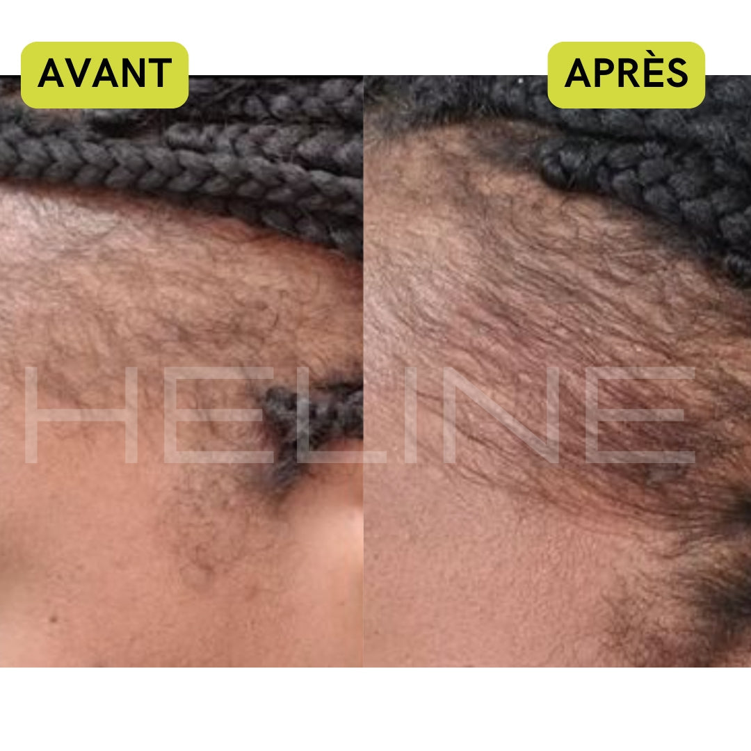 La meilleure huile de ricin bio (Conarky)