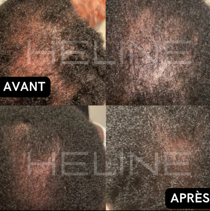 La meilleure huile de ricin bio (Conarky)